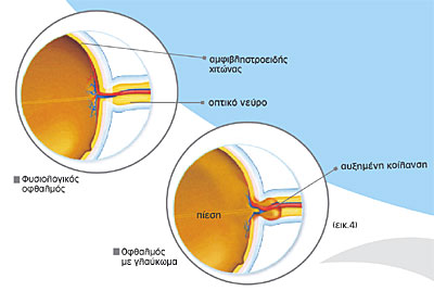 τονόμετρο pascal pascal