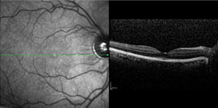 Screen Shot 2015 03 13 at 4.19.54 PM 1 Screen Shot 2015 03 13 at 4.19.54 PM 1